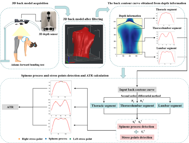 Automatic Angle of Trunk Rotation measurement for scoliosis screening